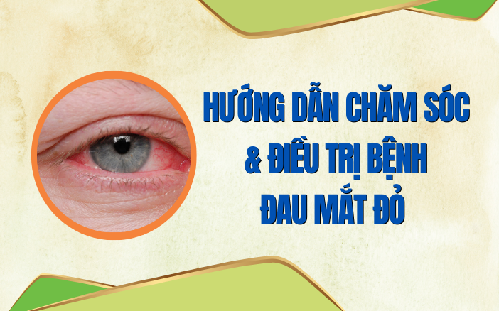 Hướng dẫn chăm sóc và điều trị bệnh đau mắt đỏ